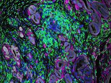 Two microscopic images are shown, each displaying complex cellular structures and tissues. The top image features a network of cells and fibers mostly in blue, green, and purple, with some areas highlighted in pink. The bottom image also shows a dense arrangement of cells and fibers with similar staining, but presents a different pattern and distribution of the colored elements.