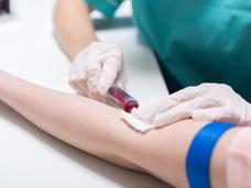 An image of a patient's arm with a blue tourniquet and nurse, arm and part of her body visible only, drawing blood.
