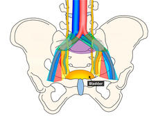 Illustration of the pelvic region showing the bladder with nearby lymph node-containing regions highlighted in different colors.