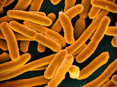 A scanning electron micrograph of E. coli, with the rod-shaped bacteria colored a mustard yellow.