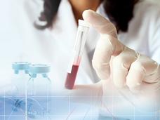 A gloved hand holds a test tube half-filled with blood vertically between the index finger and thumb.