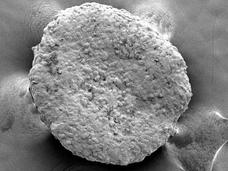 An electron microscope image showing a round, pocked clump of engineered beige fat cells.