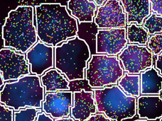 Tissue biopsy segmentation of a human lung. Blue and green shading shows different cell types and structures. Cell boundaries are outlined in white. 