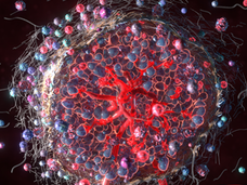 Three dimensional rendering of a cancer tumor displaying the many different types of cells (signified by different colors and shapes) in the tumor cell microenvironment. The brightly colored cells are shown woven together into a ball, with additional cells orbiting the ball; red vasculature is shown both within the tumor and connecting to bloodstream. 
