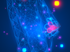 imaging of breast cancer tumor