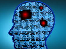 Image of a human head. Three areas in the brain are colored red to signify brain tumors. The tumors are set against a background of lines denoting artificial intelligence. 