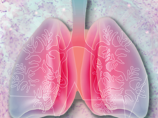 Artist illustration of lungs set against a background of a stained pathology slide.