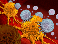 Light-colored immune cells surround and infiltrate brightly colored orange cancer cells. This denotes the concept of immunotherapy. 