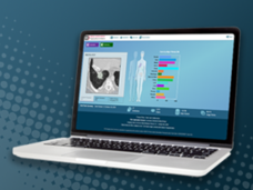 Picture of a laptop displaying the home page of NCI's Imaging Data Commons (which shows sample MRI images and bar chart of the various cancer types it has data for)