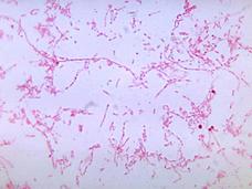 A microscopic view of Fusobacterium necrophorum. The bacteria is colored reddish pink, is thin and has various lengths - some fairly short, others quite long.