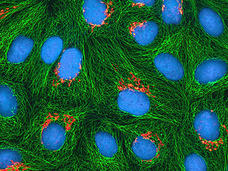 Fluorescence microscopy image of cells showing blue-stained cell nuclei surrounded by a network of green cytoskeletal filaments (likely actin or microtubules). Small red dots are visible between some of the cells.