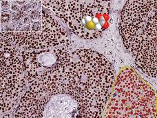 A computer generated image of a small molecule drug sits on top of a microscopically enlarged view of cells.