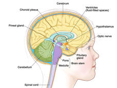 An illustrated cross section of a child’s brain, labeling the choroid plexus, cerebrum, ventricles, hypothalamus, optic nerve, pituitary gland, brain stem (pons and medulla), spinal cord, cerebellum, and pineal gland.