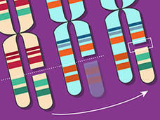 Image of three sets of chromosomes with gene fusion resulting from a chromosome translocation.