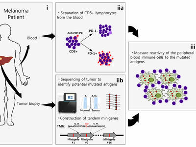 A four-panel infographic. The first panel is titled Melanoma Patient, with blood and tumor biopsy labeled on a man’s silhouette. The blood label points to a panel titled “separation of CD8 + lymphocytes from the blood”. The tumor biopsy label points to a panel titled “sequencing of tumor to identify potential mutated antigens”. These two panels point to a final panel about the measurement of reactivity of peripheral immune cells to mutated antigens.