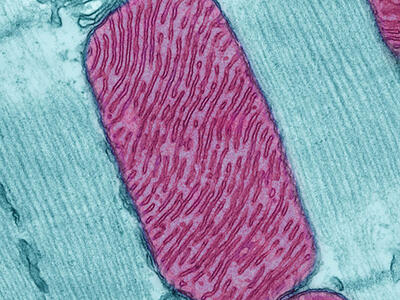 A pink-red rectangle with rounded corner and wavy lines of varying lengths (mitochondria) sits on top of a light teal background with vertical striations and some small irregularities.