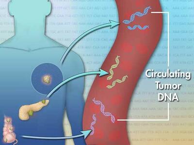 Illustration depicting the concept of circulating tumor DNA (ctDNA). It shows a human figure with highlighted organs, where tumor DNA originates. Arrows point from the tumors to a large, stylized blood vessel, where DNA strands are illustrated floating. The background features a sequence of DNA code, emphasizing the genetic aspect of cancer detection and monitoring.