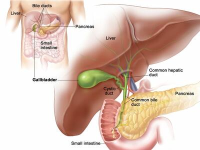 A dual illustration of the gastrointestinal system and the gallbladder with surrounding organs. The gastrointestinal diagram is smaller and labels the bile ducts, pancreas, small intestine, gallbladder, and liver. The label gallbladder then points to the larger illustration, which labels the gallbladder, liver, common hepatic duct, pancreas, common bile duct, cystic duct and small intestine.