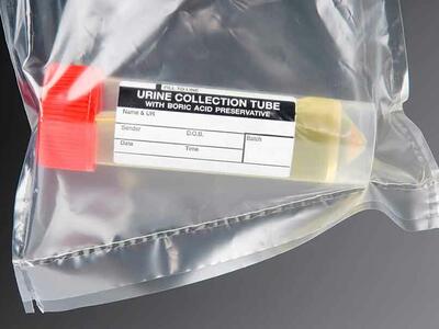 Urine collection sample inside a sealed plastic bag.