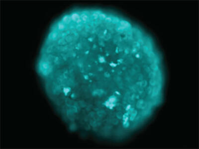 A teal, dome-shaped structure.  It is mostly dark teal with some lighter highlights.