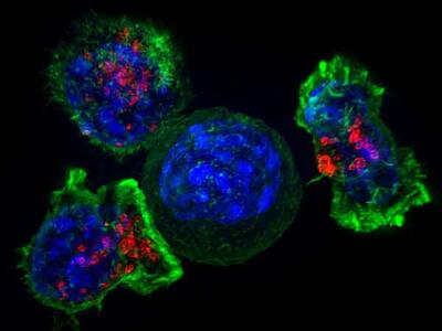 A cytotoxic T cell, colored with a neon green outline and red, blue and black on the interior, moves towards a cancer cell. The cancer cell is in the center and has a medium green viscous covering inside of a blue core. Two other cells, with similar coloring to the T cell, float to the top left and right of the cancer cell. 