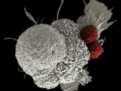 A large cancer cell, white and grey with an exterior composed of small lumps, floats on black. Two red immune cells, similar in texture and approximately 10% of the size of the cancer cell, are attached to the right side of the cancer cell.