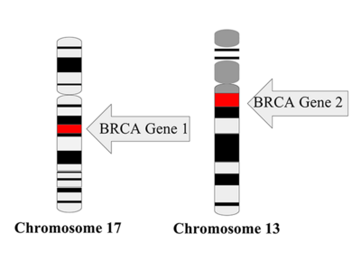 Illustration of BRCA Gene 1 (chromosome 17) and BRCA Gene 2 (chromosome 13)