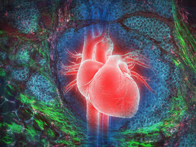 An illustration of an anatomical heart over top of breast cancer cells.