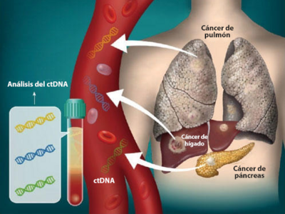 Imagen en la que se observa el ADN que se separa de los tumores y circula en la sangre.