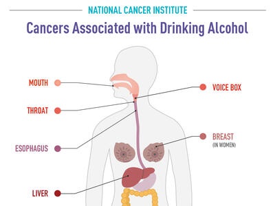 Cancers Associated with Drinking Alcohol Infographic