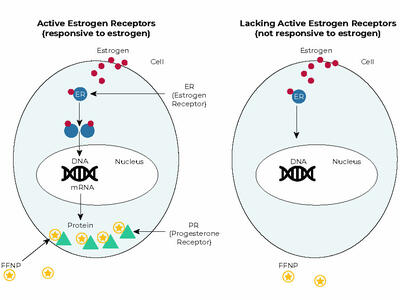 Illustration comparing two cells: one with active estrogen receptors (left) and one lacking them (right). The left cell shows estrogen binding to receptors, leading to DNA interaction and protein production, including progesterone receptors. The right cell, without active receptors, shows no such activity.