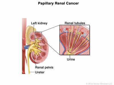 Illustration of kidney anatomy showing renal tubules
