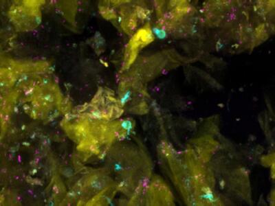 A skin micrograph showing skin cells, bacteria, and fungi.