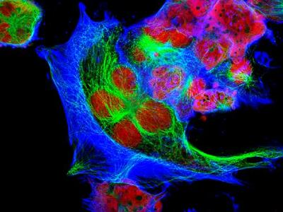 Imagen de células de neuroblastoma tomada con microscopio de fluorescencia. 
