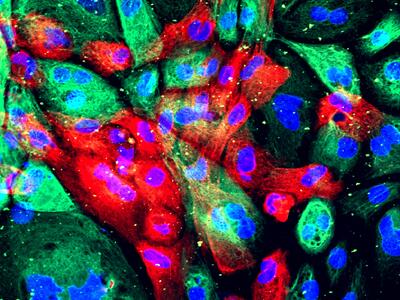 Microscopic image of a dense cluster of human prostate cells in vibrant reds, green and blues.