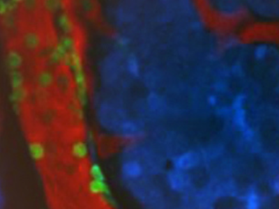 Immunofluorescent image of a tumor microenvironment