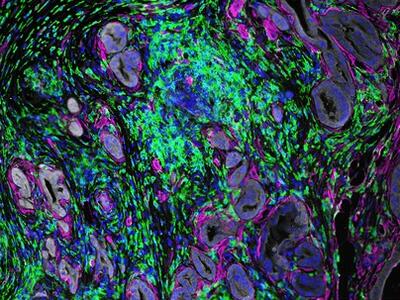 Two microscopic images are shown, each displaying complex cellular structures and tissues. The top image features a network of cells and fibers mostly in blue, green, and purple, with some areas highlighted in pink. The bottom image also shows a dense arrangement of cells and fibers with similar staining, but presents a different pattern and distribution of the colored elements.