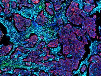 Imaging Mass Cytometry