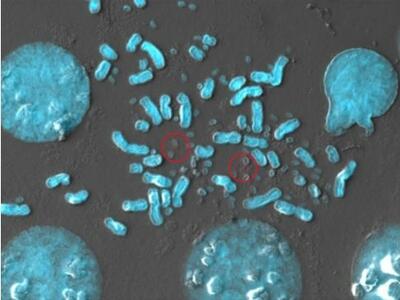 Cellular level imaging of a tissue sample shows many ecDNAs in and about chromosomes.