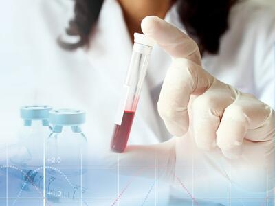 A gloved hand holds a test tube half-filled with blood vertically between the index finger and thumb.