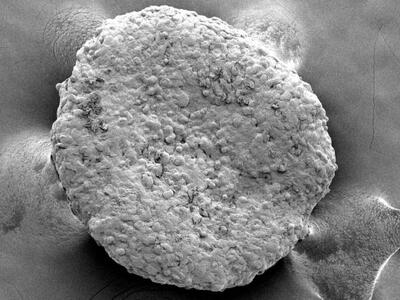 An electron microscope image showing a round, pocked clump of engineered beige fat cells.