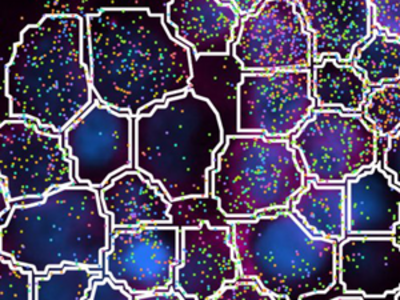 Tissue biopsy segmentation of a human lung. Blue and green shading shows different cell types and structures. Cell boundaries are outlined in white. 