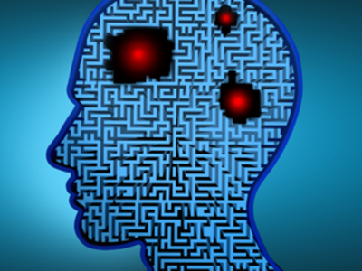 Image of a human head. Three areas in the brain are colored red to signify brain tumors. The tumors are set against a background of lines denoting artificial intelligence. 