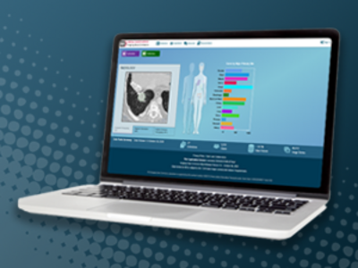 Picture of a laptop displaying the home page of NCI's Imaging Data Commons (which shows sample MRI images and bar chart of the various cancer types it has data for)