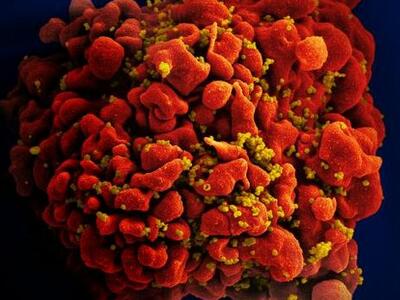 A red infected t-helper cell with yellow viral proteins indicating the cell is actively replicating the virus.