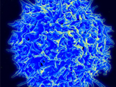A view of a T cell. The exterior is mostly medium blue, with light highlights. The overall structure is round with an exterior of bumpy pieces that abut or intertwine with each other. Certain strands hang off the cell a bit further than others.