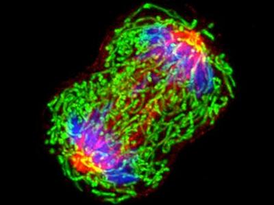 A dividing breast cancer cell.