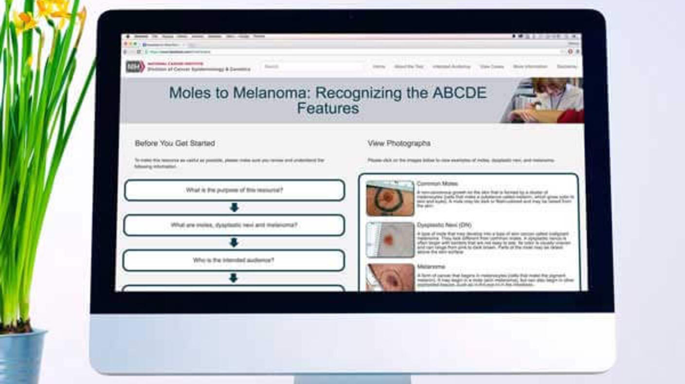 Desktop computer displaying a medical education website about "Moles to Melanoma: Recognizing the ABCDE Features" with interactive questions on the left and medical photographs on the right, shown next to a small potted plant.