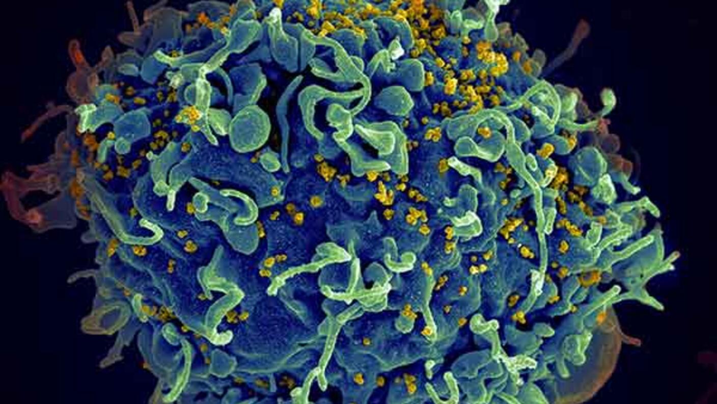 A human T cell being attacked by the human immunodeficiency virus (HIV).