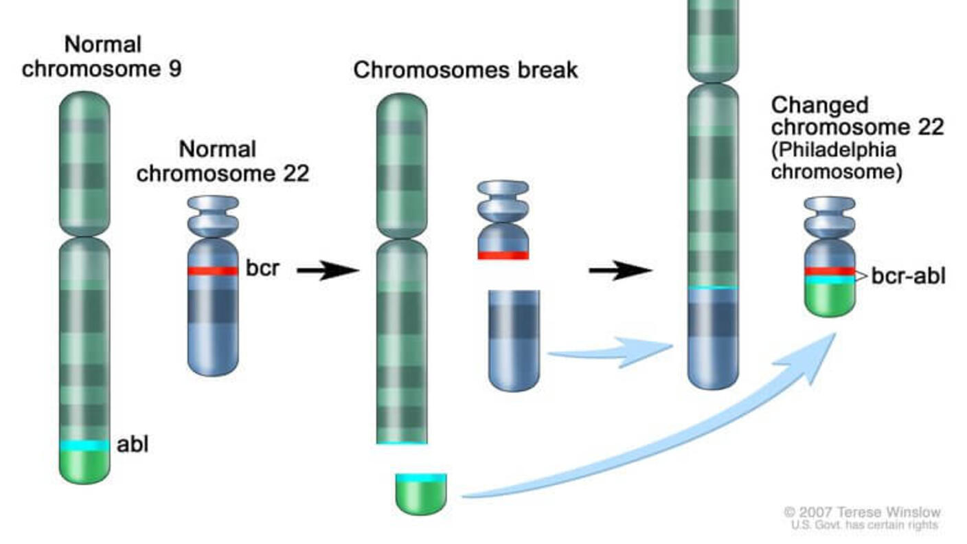 Illustration of chromosomal translocation involving chromosomes 9 and 22, showing chromosomal breaking and exchange, that results in the Philadelphia chromosome. The illustration highlights the abl gene on chromosome 9 and the bcr gene on chromosome 22, which form the bcr-abl fusion on the altered chromosome 22.